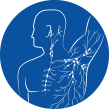 Stages of Lymphedema